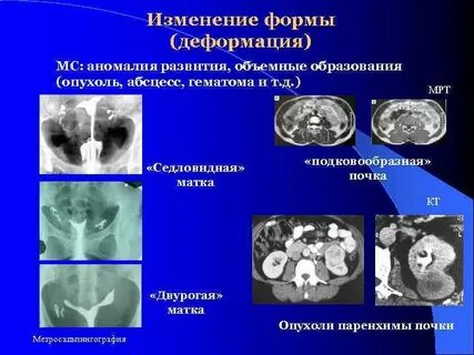 Аномалии развития у мужчин