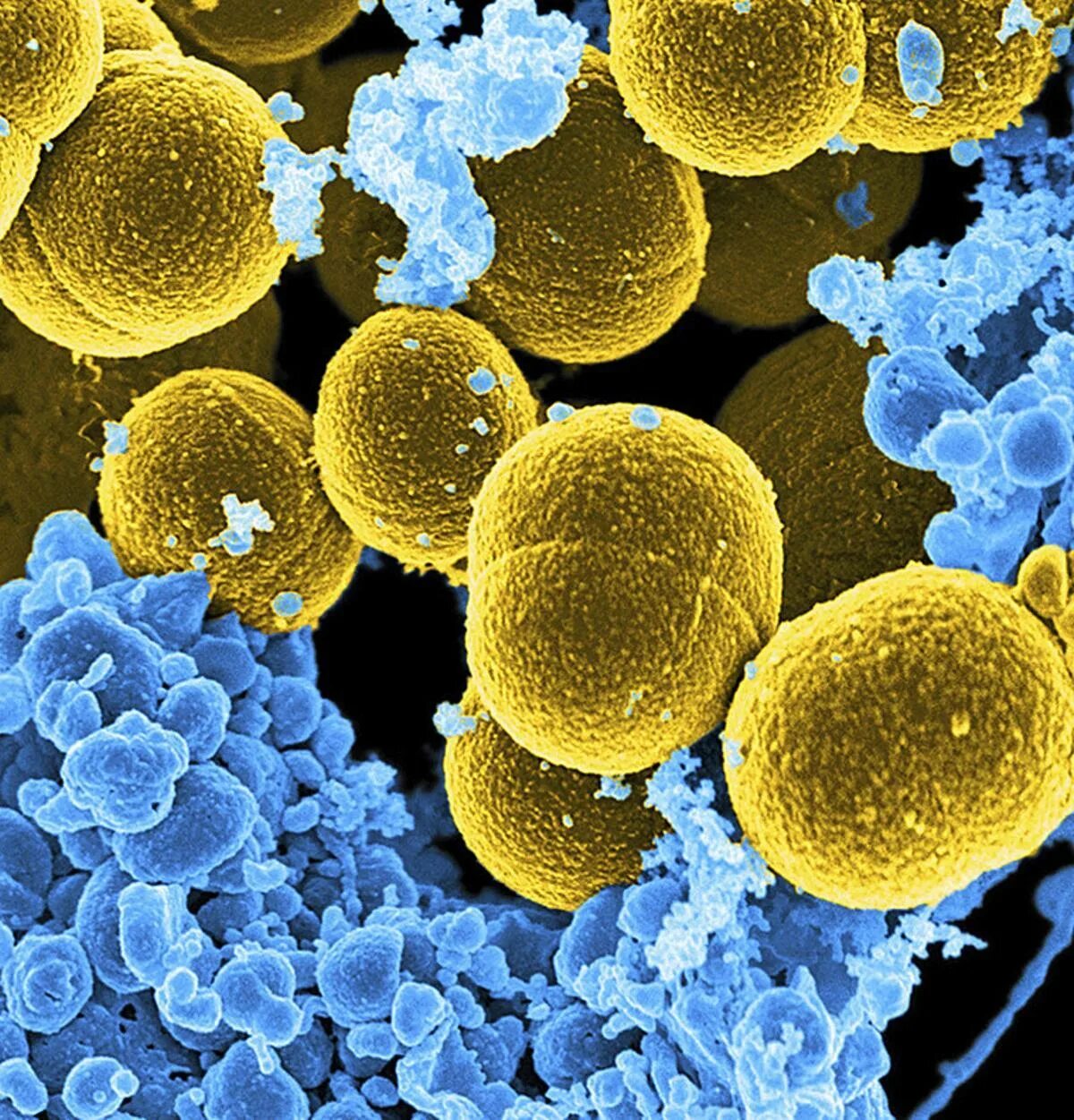 Грипп какие бактерии. Золотистый стафилококк MRSA. S. aureus золотистый стафилококк. Бактерия стафилококк ауреус. Стафилококкус ауреус.