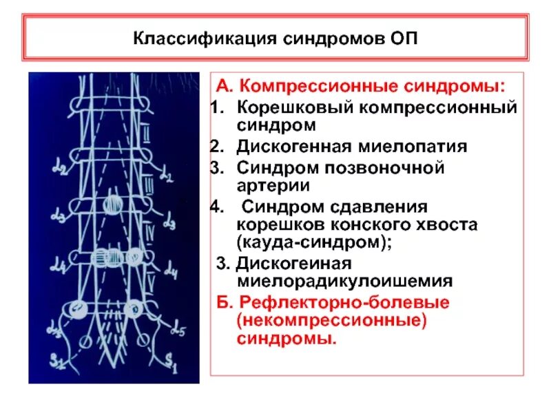 Корешковое поражение. Корешок l3 корешковый синдром. Спондилогенный компрессионный корешковый синдром l5. Дорсопатия корешковый синдром. Корешковый синдром классификация.