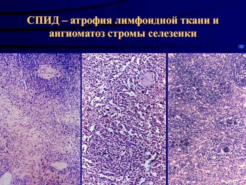 Изменение тканей