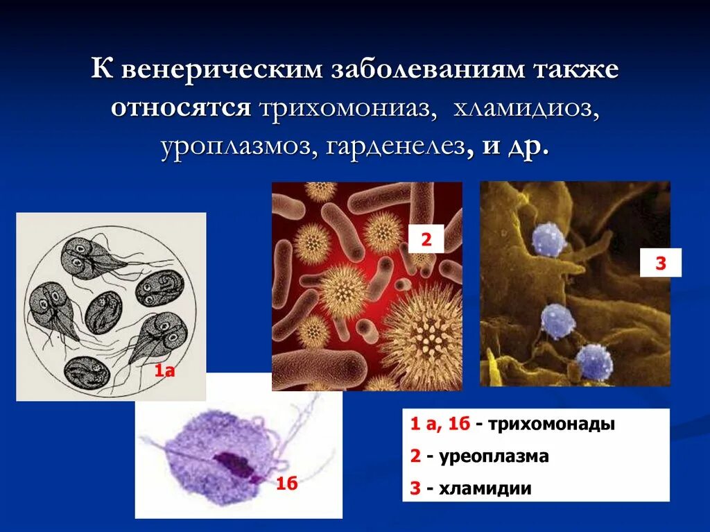 Инфекция половых путей у мужчин. Венерические заболевания. Невенеричечкие заболевания. Виринтческие заболевания. К венерическим заболеваниям относят:.