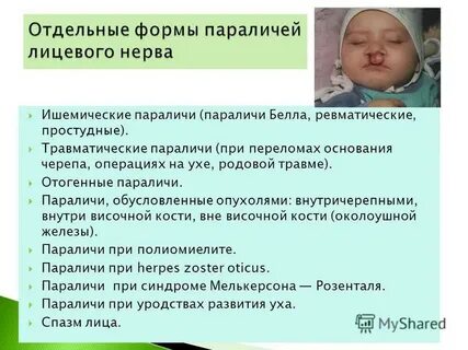 Дцп родовая травма