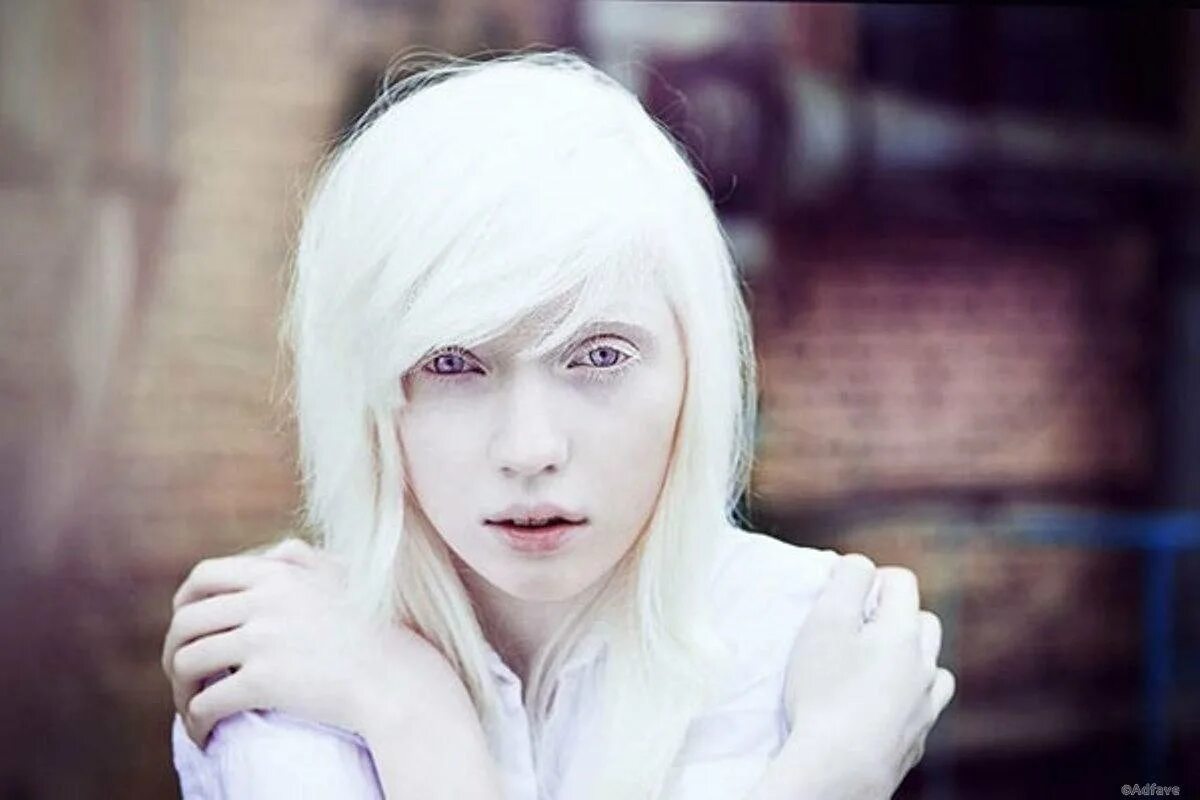 Европеоид альбинос. Бледная кожа как называется. Саша лусс альбинос. Светлые брови у девушек. Катерина тимошенко альбинос.