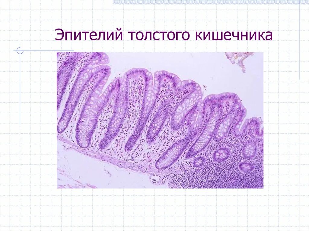 Ткани тонкой кишки. Эпителий тонкой кишки гистология. Эпителий толстой кишки гистология. Каемчатый эпителий гистология. Однослойный призматический каемчатый эпителий тонкого кишечника.