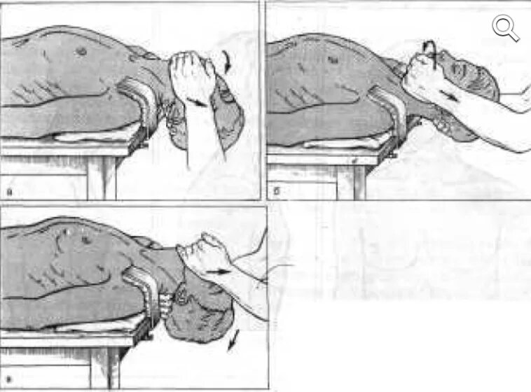 Методики вправления позвонков. Методы вправления шейных позвонков. Подвывих Атланта после вправления. Вправление вывиха Атланта. Вправление позвоночника