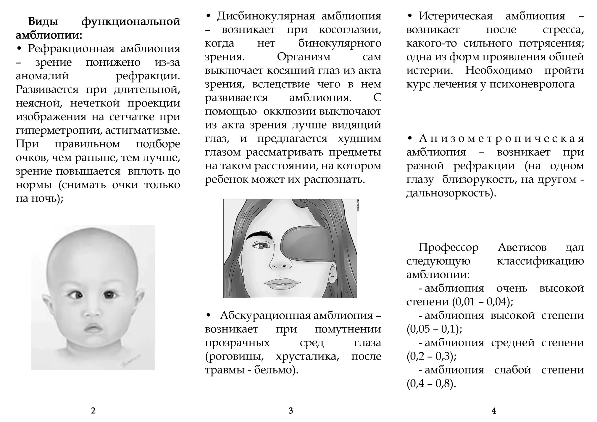 У ребенка зрение 1 5. Виды амблиопии. Амблиопия левого глаза высокой степени. Амблиопия рекомендации. Амблиопия у детей.