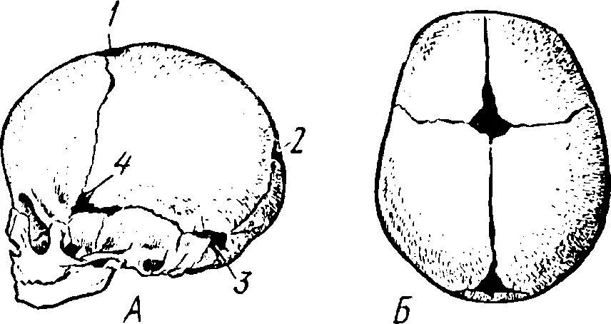 Роднички плода. Роднички черепа анатомия. Кости черепа роднички. Роднички у младенцев анатомия. Сосцевидный Родничок у новорожденных.