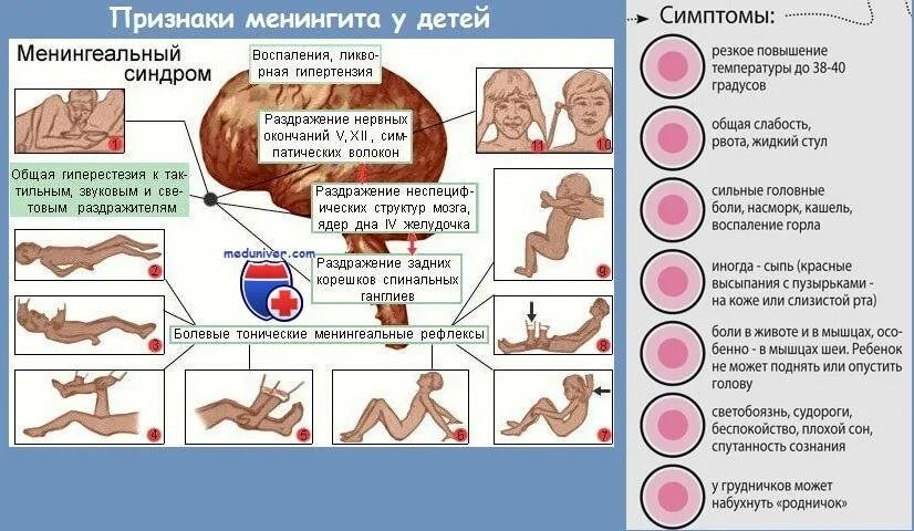 Последствия менингита у взрослых