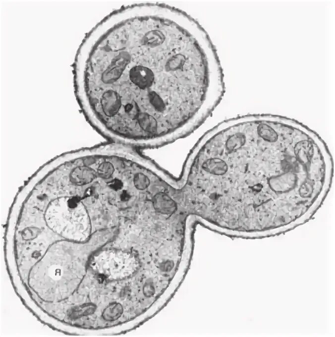 Первая дочерняя клетка. Почкующиеся дрожжевые клетки в ликворе.
