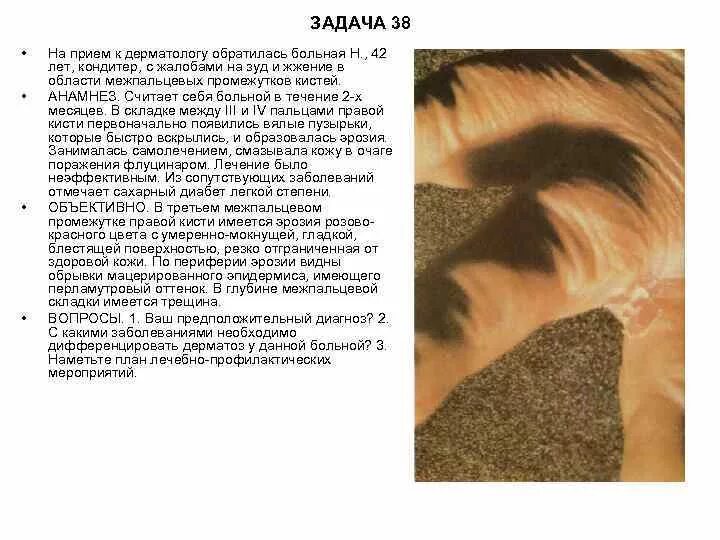 Обратилась женщина с жалобами на зуд. Локальный статус в истории болезни. Пациент 40 лет обратился к дерматологу. Обратилась женщина с жалобами на зуд. Обратилась женщина с жалобами на зуд.