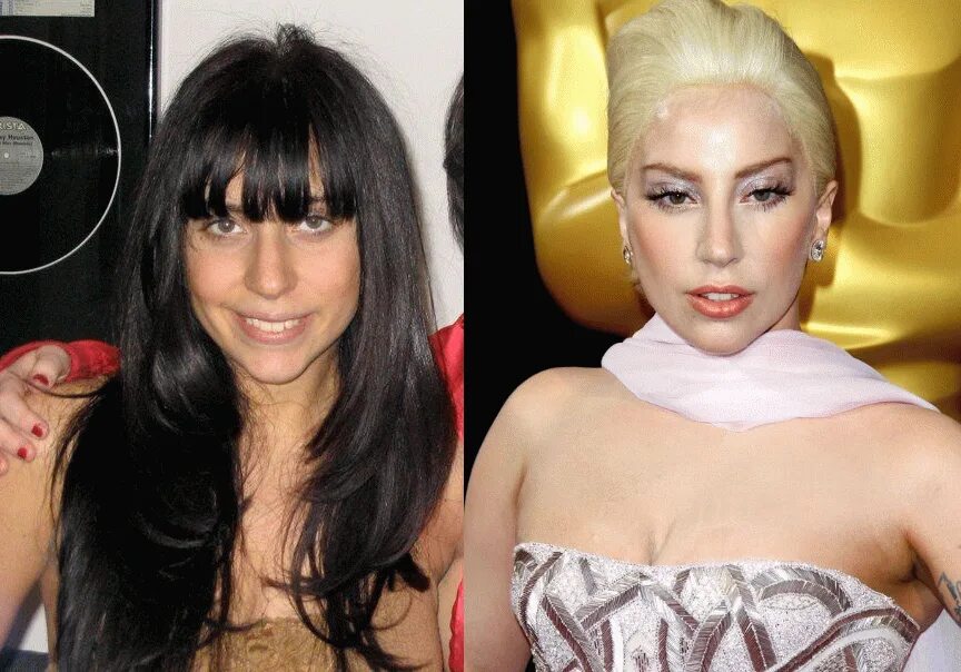 Леди гага до пластики и после фото Lady plastic: найдено 84 изображений