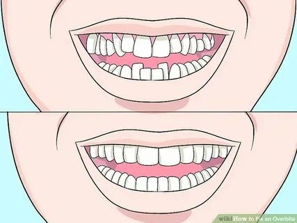 Почему шевелятся зубы