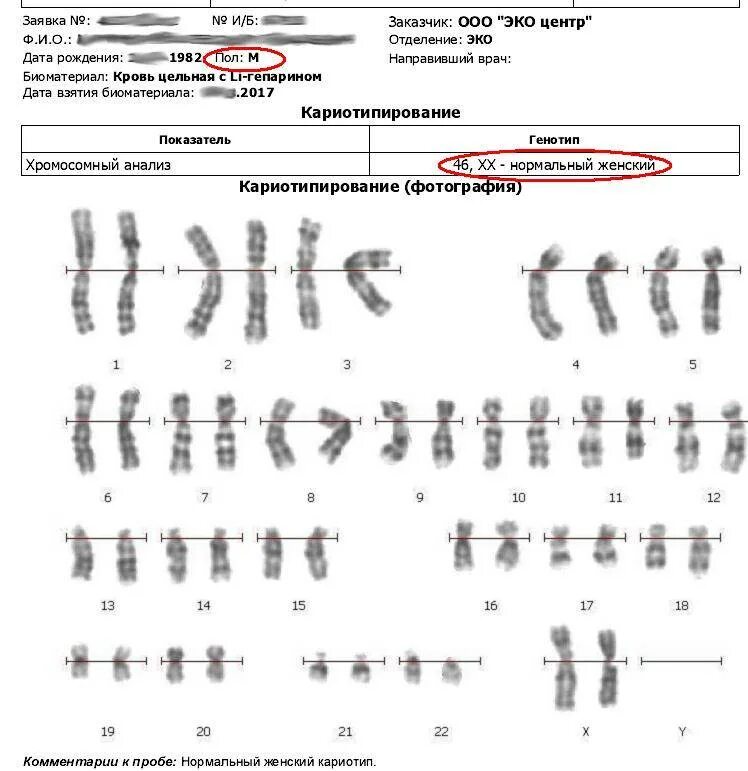 Определение числа хромосом в кариотипе метод. Определение числа хромосом в кариотипе метод