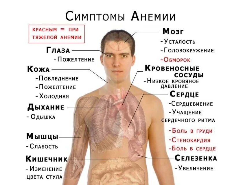 Какие болезни при недостатке железа. Какие болезни при недостатке железа