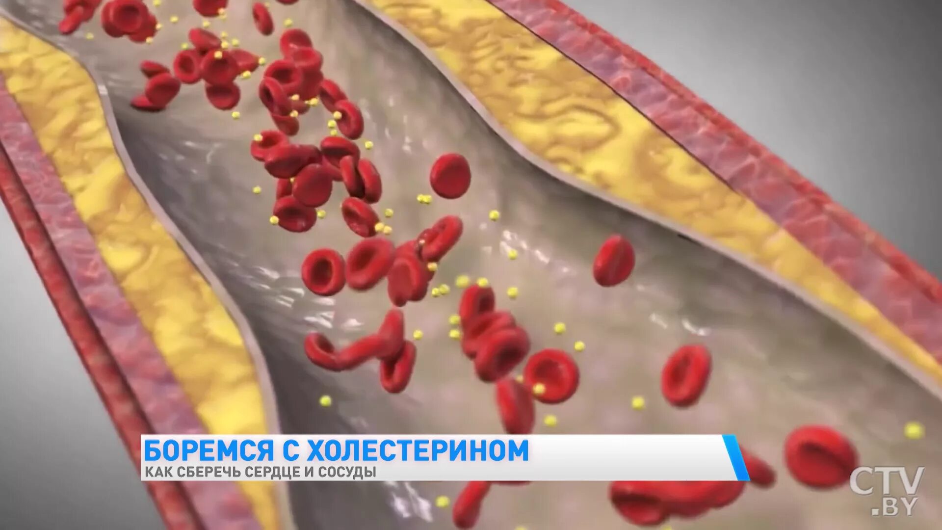 Холестерин к чему приводит. Несколько повышенный уровень холестерина. Сердечно-сосудистой холестерин. Холестерин кристаллизованный.