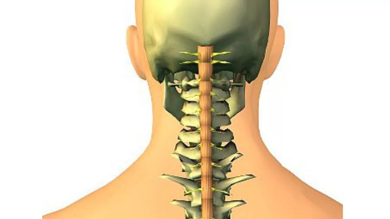 Остеохондроз шейного отдела. Остеохондроз шейного отдела фото. Позвоночник шея.