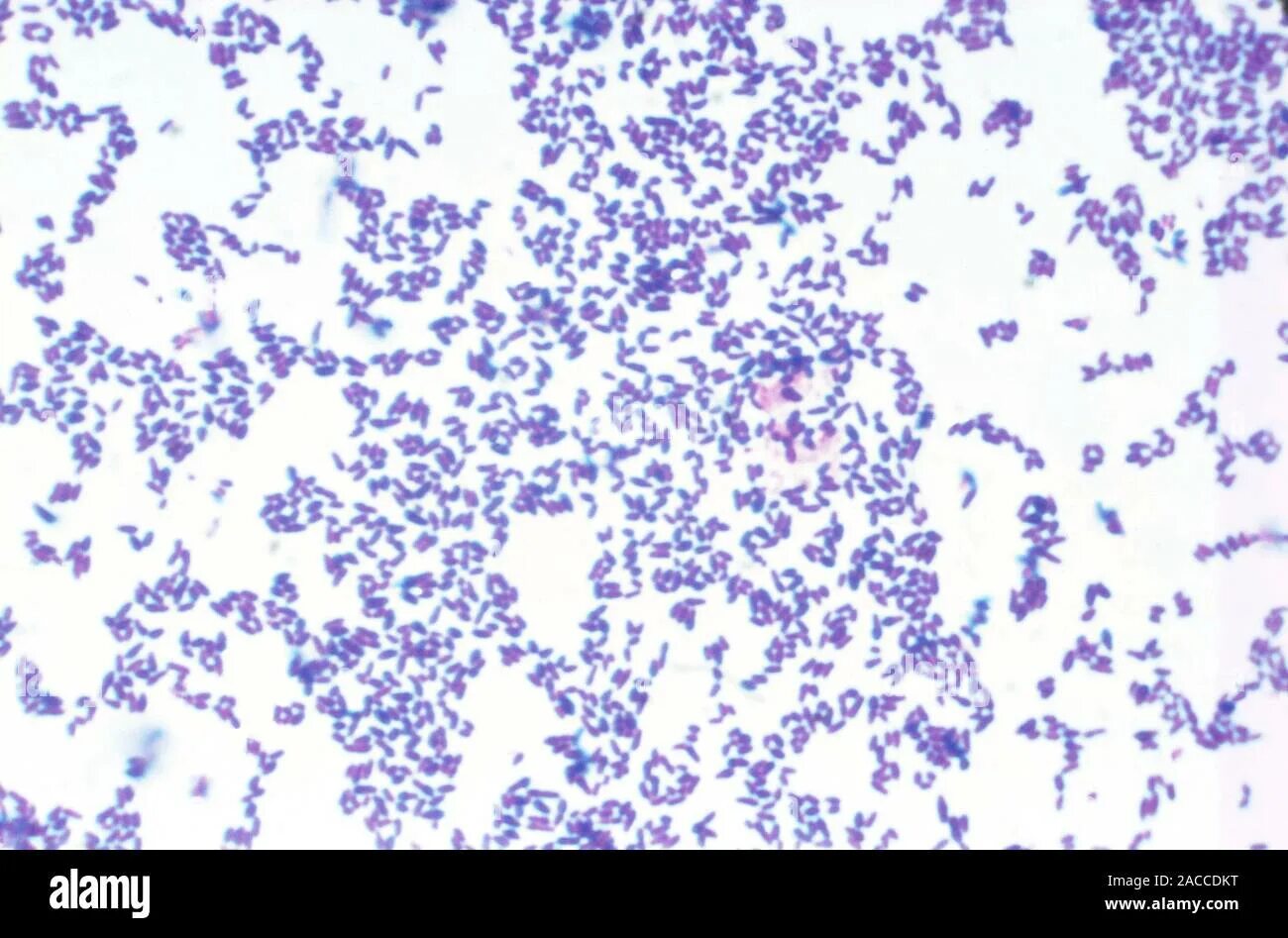 Mobiluncus spp corynebacterium в мазке. Corynebacterium diphtheria. коринобактерия дифтерия. коринебактериум дифтерия. коринебактерии дифтерии микробиология.