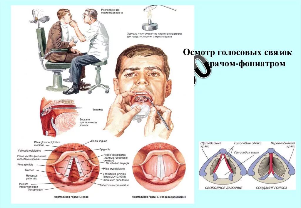 Голосовые связки у человека. Голосовая связка гортани. Колебание голосовых связок. Расположение голосовых связок. Между голосовыми связками голосовая