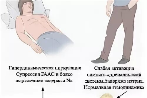 Дренаж при асците