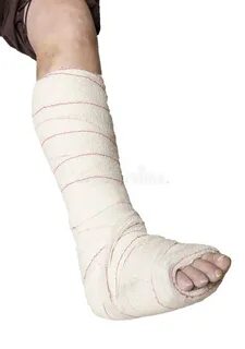 She broke has broken her leg