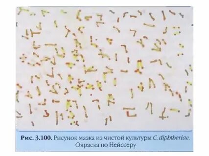 Метод окраски нейссера