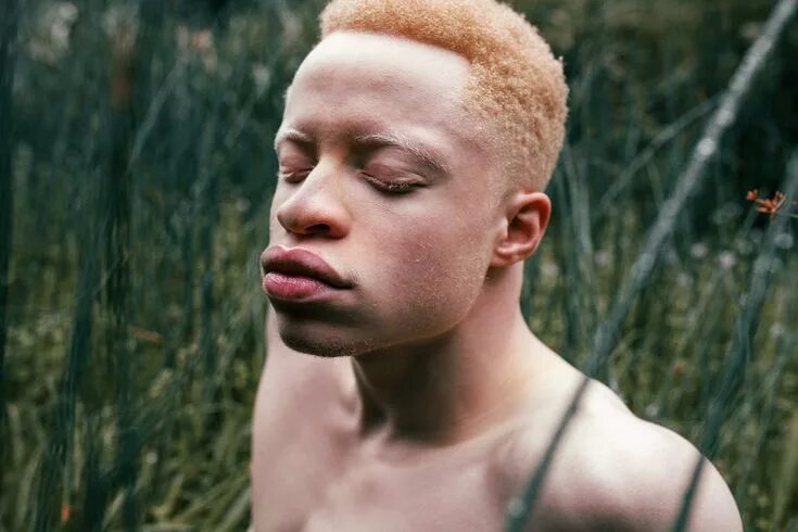 Как выглядит белый негр Pin by Rafael Correa on Character's Tutorial Beauty, Black beauties, Baby face
