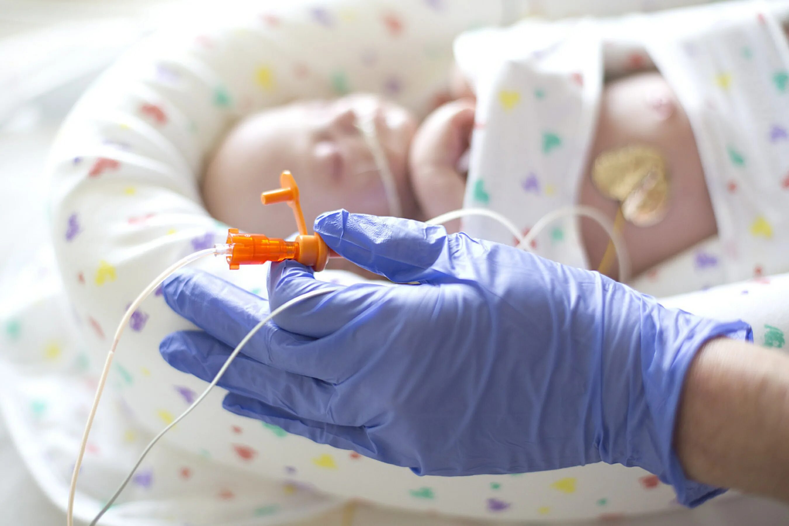 Семимесячный ребенок температуре. Зонд для недоношенных детей. Парентеральное питание новорожденных. Энтеральное питание недоношенных.