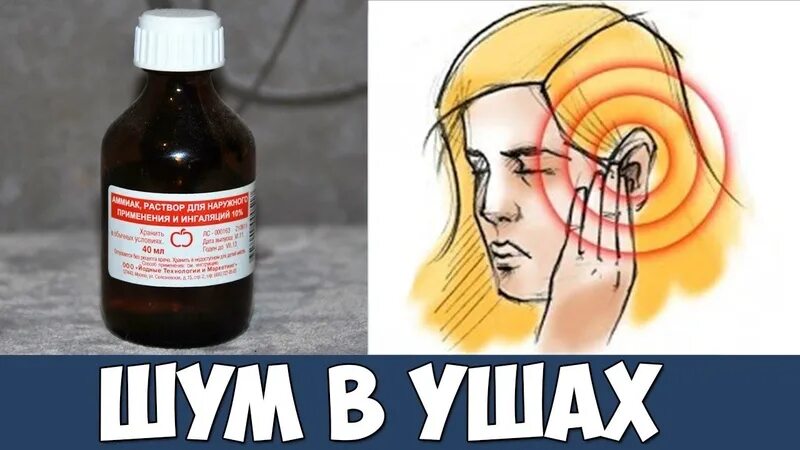 В голове какие то звуки. От шума в ушах и голове. лекарства при шуме в ушах и голове. шум в ушах народная средства. препараты от свиста в голове.