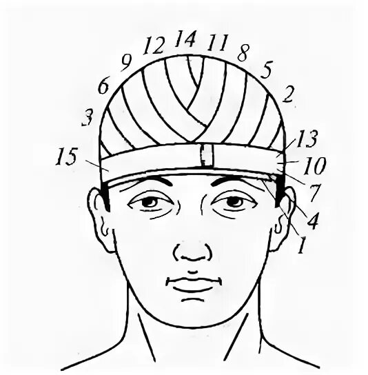 Техника наложения шапочки гиппократа. Перевязка головы шапочка Гиппократа. Наложение повязки шапочка Гиппократа. Чепец и шапочка Гиппократа. Шапочка Гиппократа повязка характеристика.