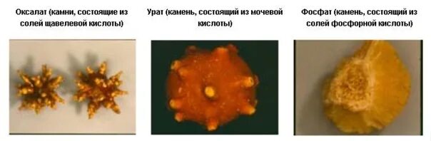 Как понять что у тебя камни: найдено 81 изображений