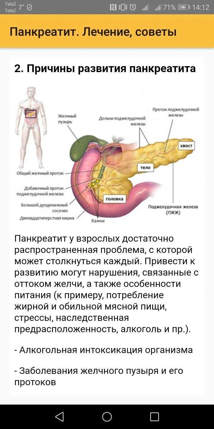 Панкреатит спазмы. Лекарства воспаление поджелудочной железы панкреатит. болезнь хронический панкреатит поджелудочной железы. острый панкреатит хронический панкреатит. симптомы при панкреатите поджелудочной железы.