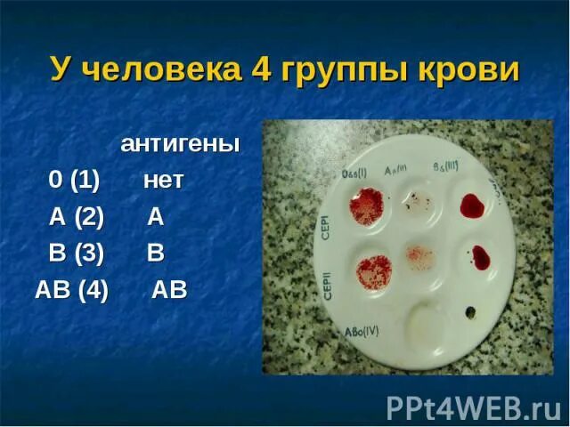 Распространенная группа крови в мире. Самая распространенная группа крови. Редкая группа крови. Самыераспространнеые группы крови. Группы крови самые распространенные и редкие.