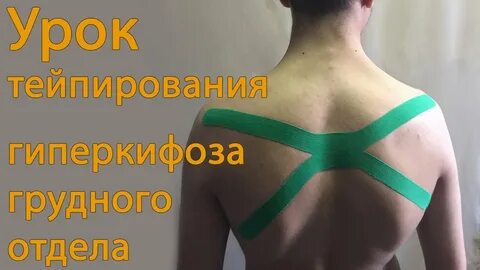 Схема тейпирования спины