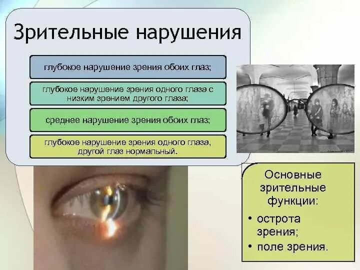 Значение зрения нарушение. Нарушение зрения. Глубокое нарушение зрения это. Причины нарушения зрения. Проявление нарушений зрения.
