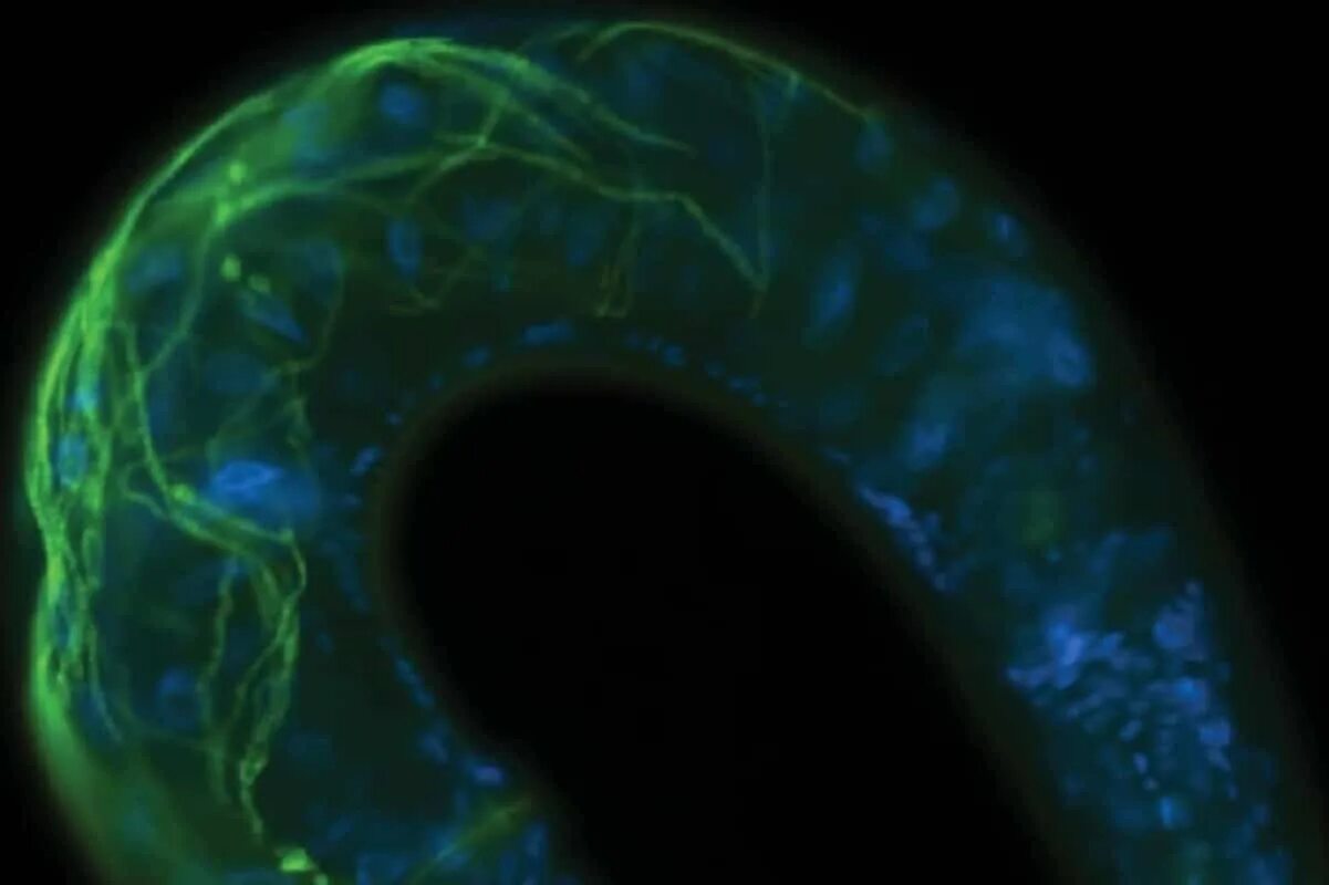 Биологи обнаружили удивительное явление. М-клетки кишечника. Клетка червяки внутри. Бордетелла клетка.