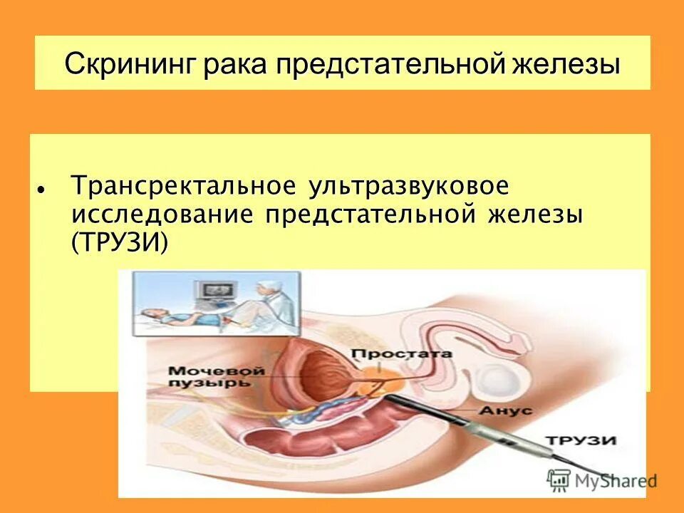 Предстательная железа узи как делают у мужчин