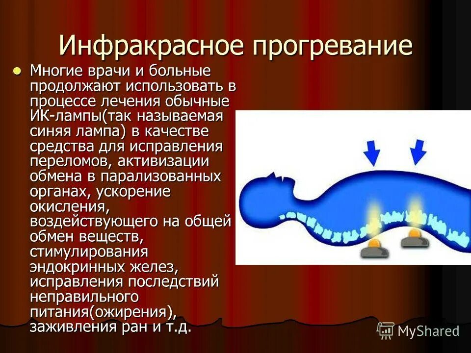 Какую прогревающую. Какую прогревающую. Схема монтажа греющего кабеля для водопровода. Какую прогревающую. Обогрев кровли сн-28 521 вт.