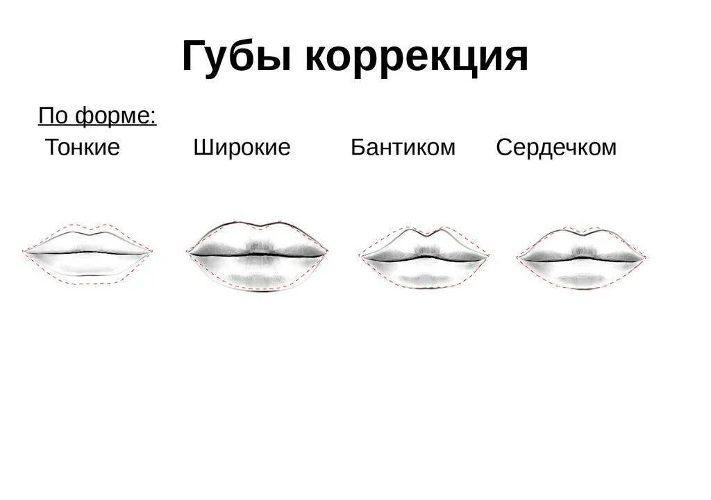 Как отличить губы. Схема коррекции губ филлером. Формы губ. Форма губ виды. Формы губ названия.