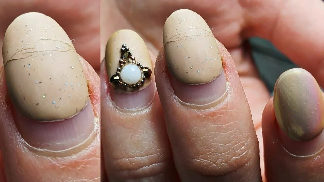 Трескающийся гель лак. Ноготь отходит от кутикулы. Почему трескается лак на ногтях. Почему трескается лак на ногтях. Гель лак потрескался.
