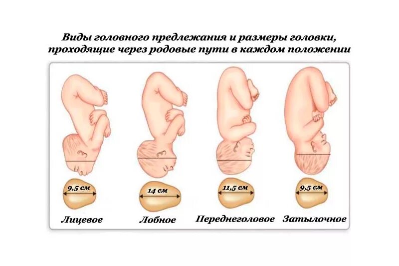 Положение плода продольное предлежание головное. Положение плода продольное головное 2 позиция передний вид. Головное предлежание плода на 32 неделе беременности. Продольное расположение плода при беременности 30 недель.