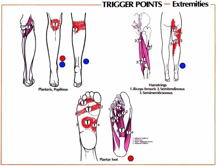 Trigger lines