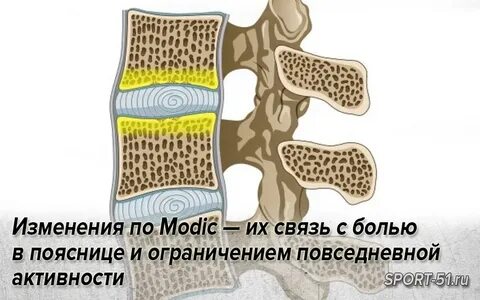 Модик 1 типа