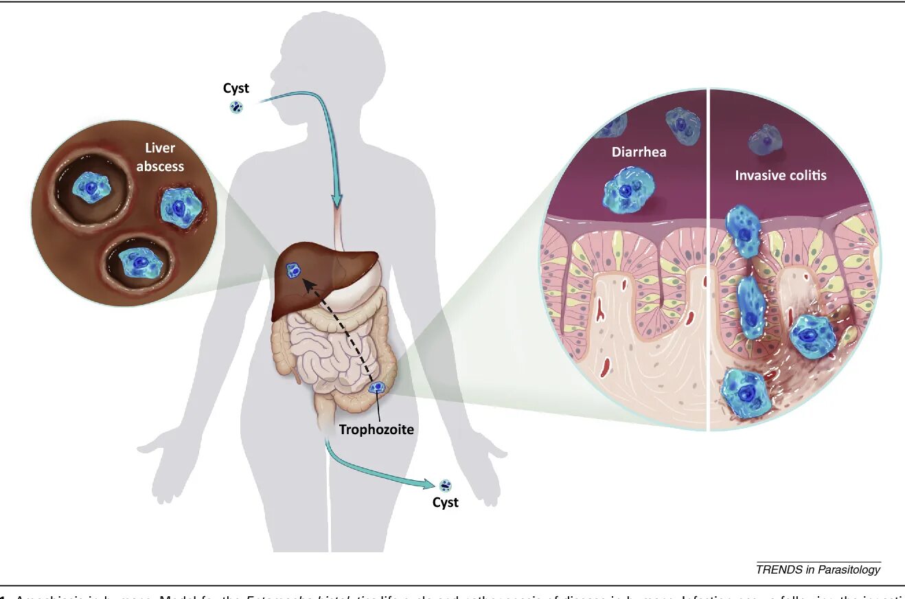 Протозойные кишечные инфекции амебиаз. Кишечный амебиаз возбудитель. Амёба дизентерийная среда обитания. Источник инфекции при амебиазе. Протозойные кишечные инфекции амебиаз.