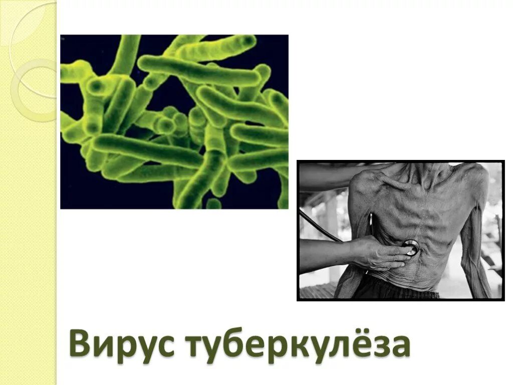 Туберкулез virus.