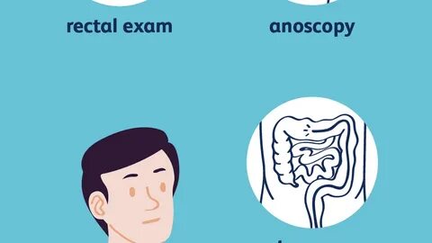 Rectal exam