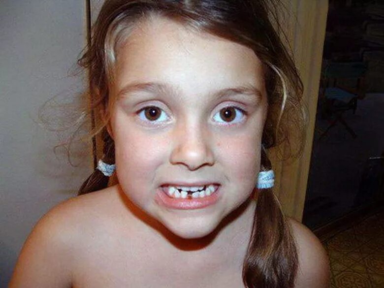 можно ли ходить без зуба. женщина без передних зубов. детская улыбка зубы. кэмерон диаз улыбка без зубов. детские беззубые улыбки.