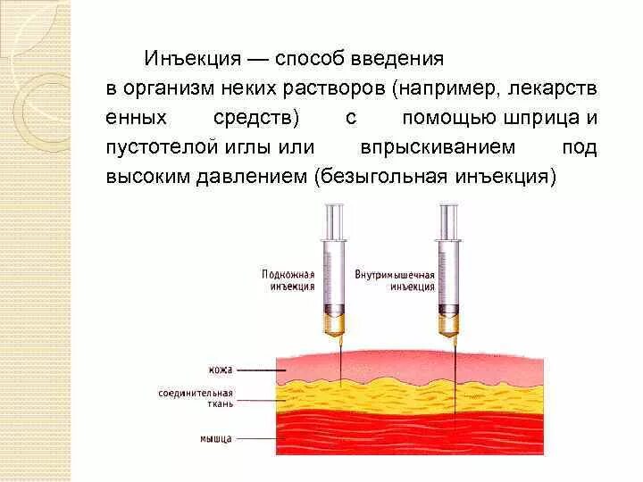 Подкожная глубина введения иглы. Инъекции внутримышечно внутривенно подкожно. Пути введения лекарственных препаратов. Виды инъекций.. Глубина введения иглы при проведении внутримышечной инъекции в мм. Способ введения инъекционных лекарственных.