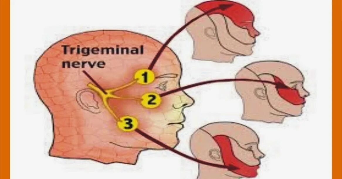 Почему немеют уши. Нейропатия тройничного нерва. Тройничный нерв. Троичный нерв воспален.