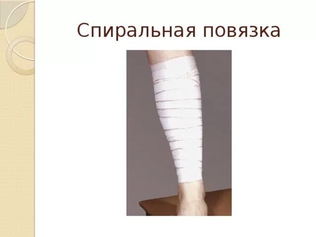 Повязка с перегибом. Спиральная повязка. спиральная повязка на голень. циркулярная и спиральная повязка. наложение спиралевидной повязки.
