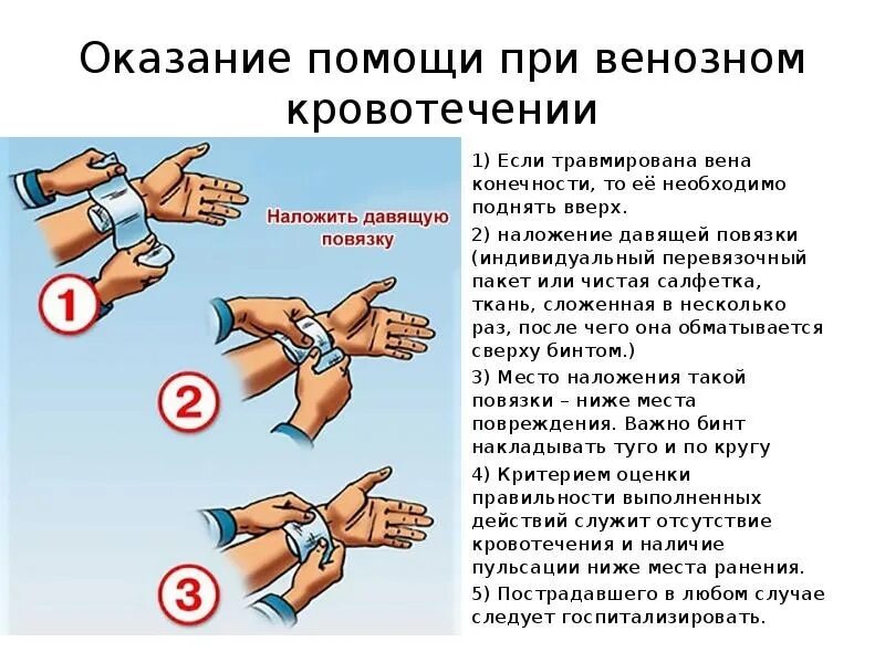 Остановка кровотечения давящей повязкой алгоритм. Венозное кровотечение наложение давящей повязки. Налодениедавящей повязки. Техника наложения давящей повязки.